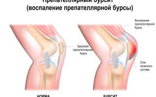 Боль в колене: причины и лечение