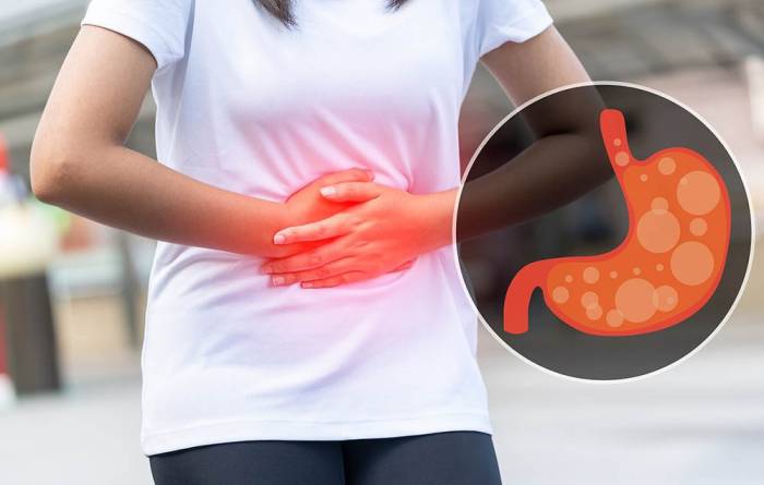 Противопоказание к употреблению папайи при гастрите Папайя и гастрит